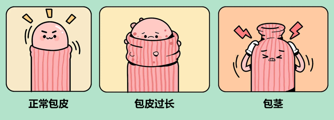 中山割包皮，中山割包皮医院，中山东方男科医院